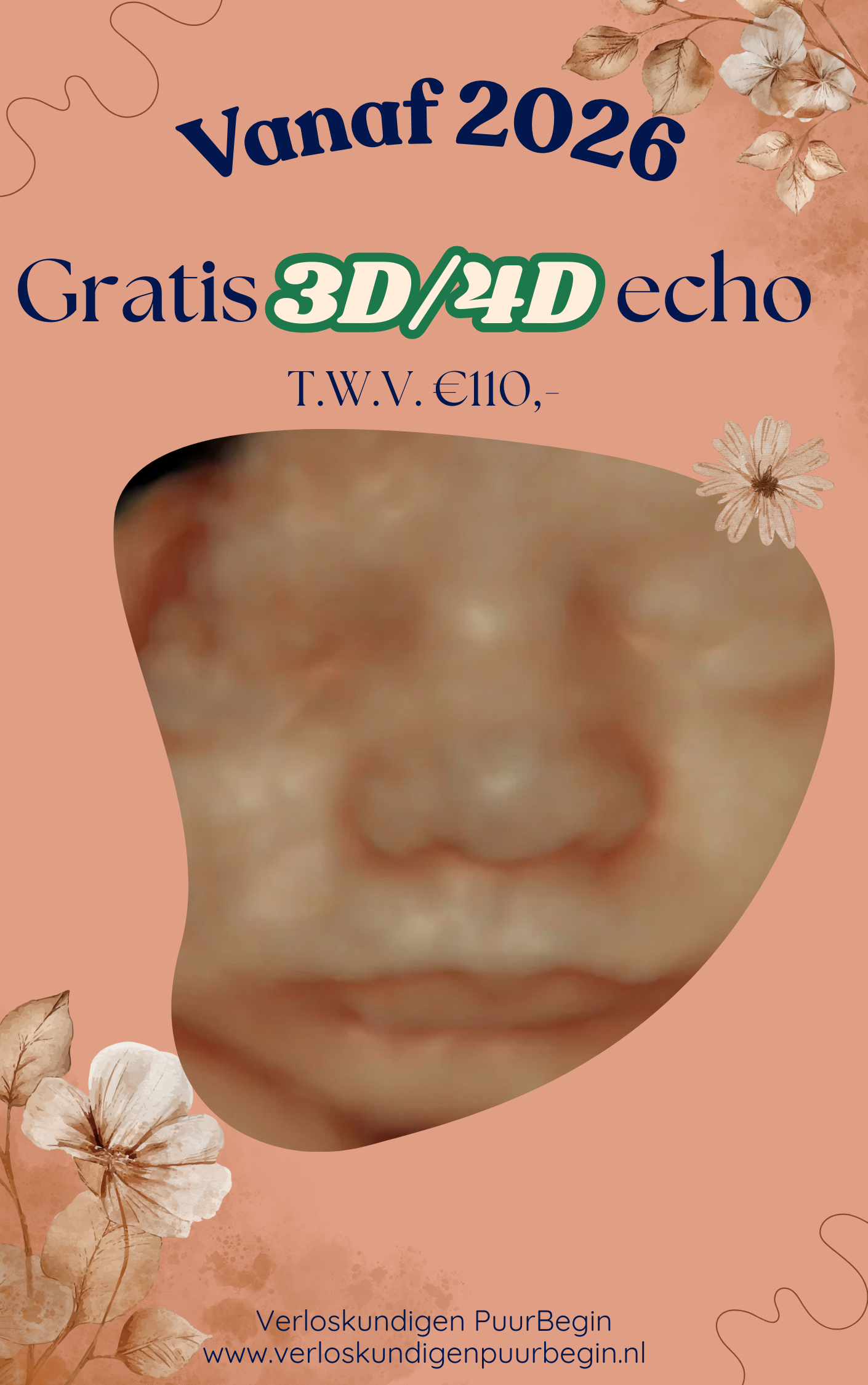Gratis 3D en 4D echo Verloskundigen PuurBegin